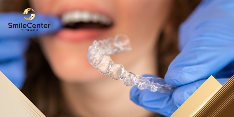 5 lý do nên niềng răng trong suốt clear aligners