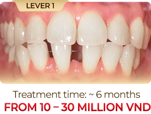 Level-1