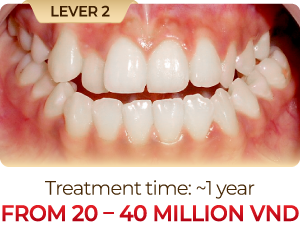 Level-2