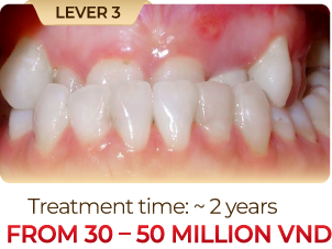 Level-4