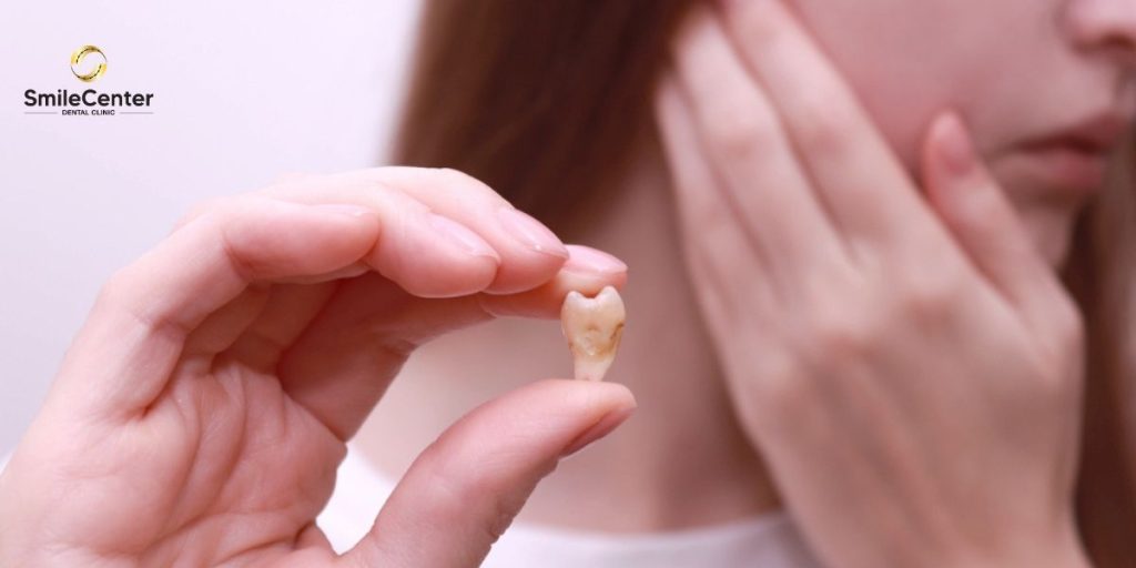 Sưng nề quanh vùng má và hàm