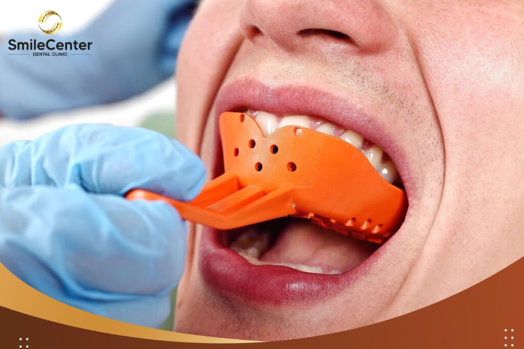 Cầu và mão răng được hình thành như thế nào?