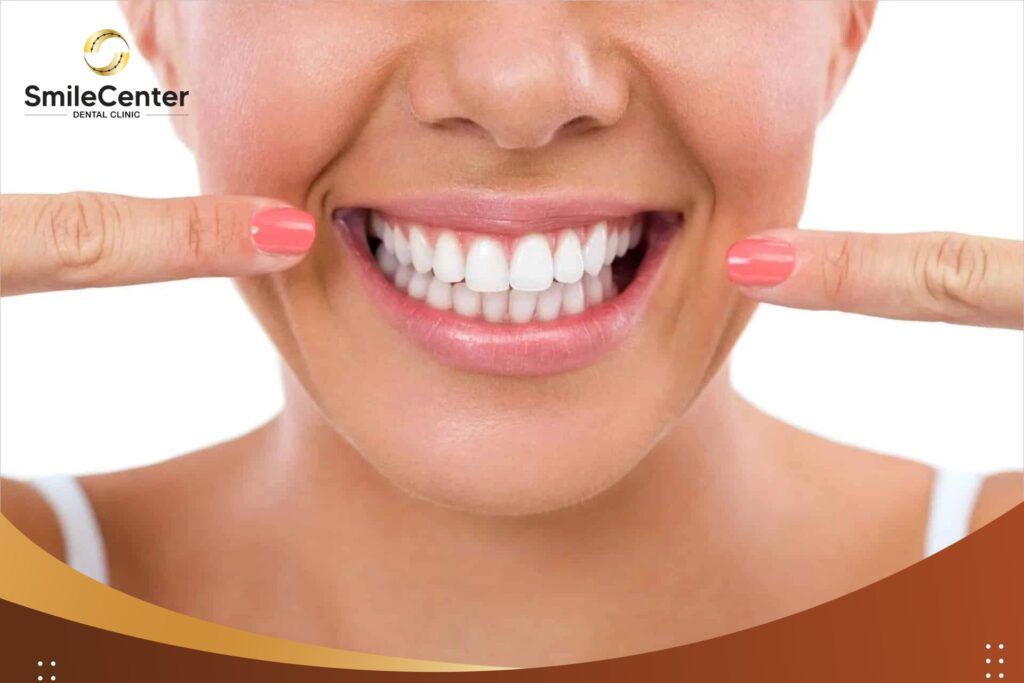Cầu và mão răng có độ bền trong bao lâu?