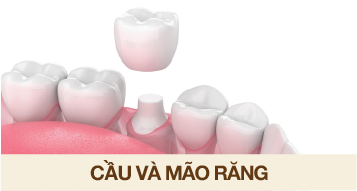 cau-va-mao-rang